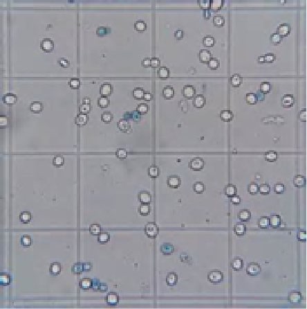 Figure 7. Example of yeast exposed to methylene blue.